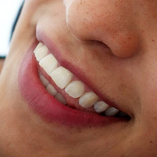 Expert Dental Care and Cosmetic Dentistry in Flemington, NJ -