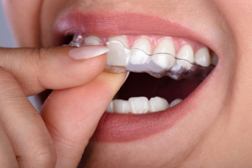 Expert Dental Care and Cosmetic Dentistry in Flemington, NJ -