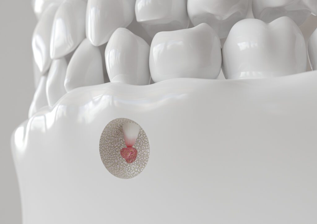 Expert Dental Care and Cosmetic Dentistry in Flemington, NJ -