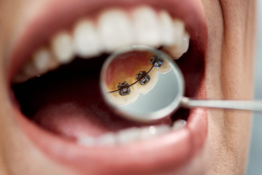 Expert Dental Care and Cosmetic Dentistry in Flemington, NJ -