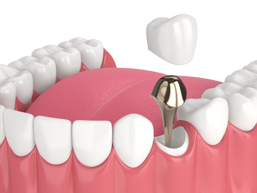 Expert Dental Care and Cosmetic Dentistry in Flemington, NJ -