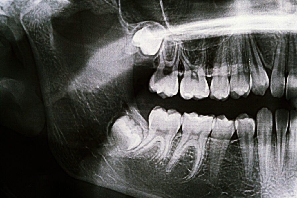 Expert Dental Care and Cosmetic Dentistry in Flemington, NJ -