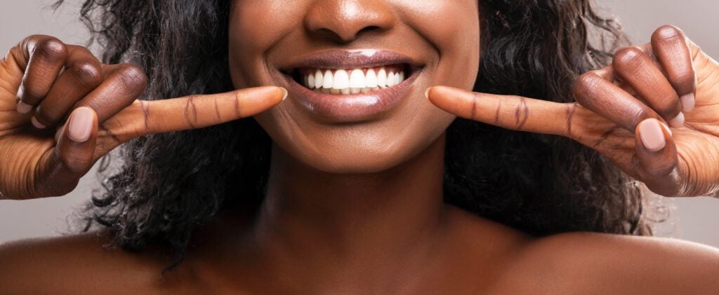 teeth whitening in Flemington