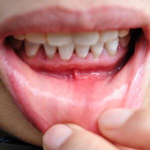 Expert Dental Care and Cosmetic Dentistry in Flemington, NJ -
